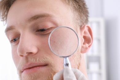 Dermatologist examining patient with magnifying glass in clinic, closeup view