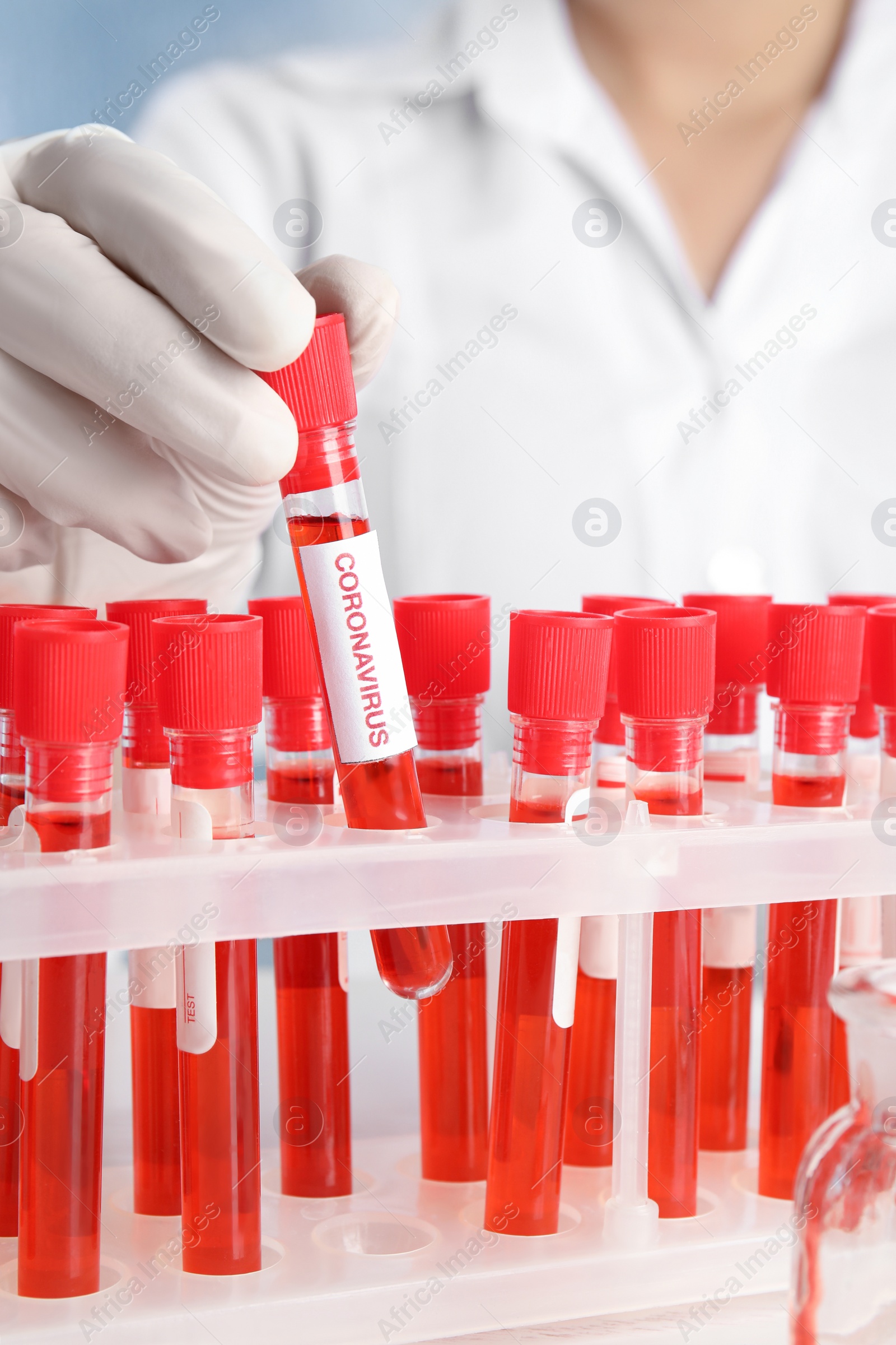 Photo of Scientist taking test tube with blood sample and label CORONA VIRUS from rack in laboratory, closeup