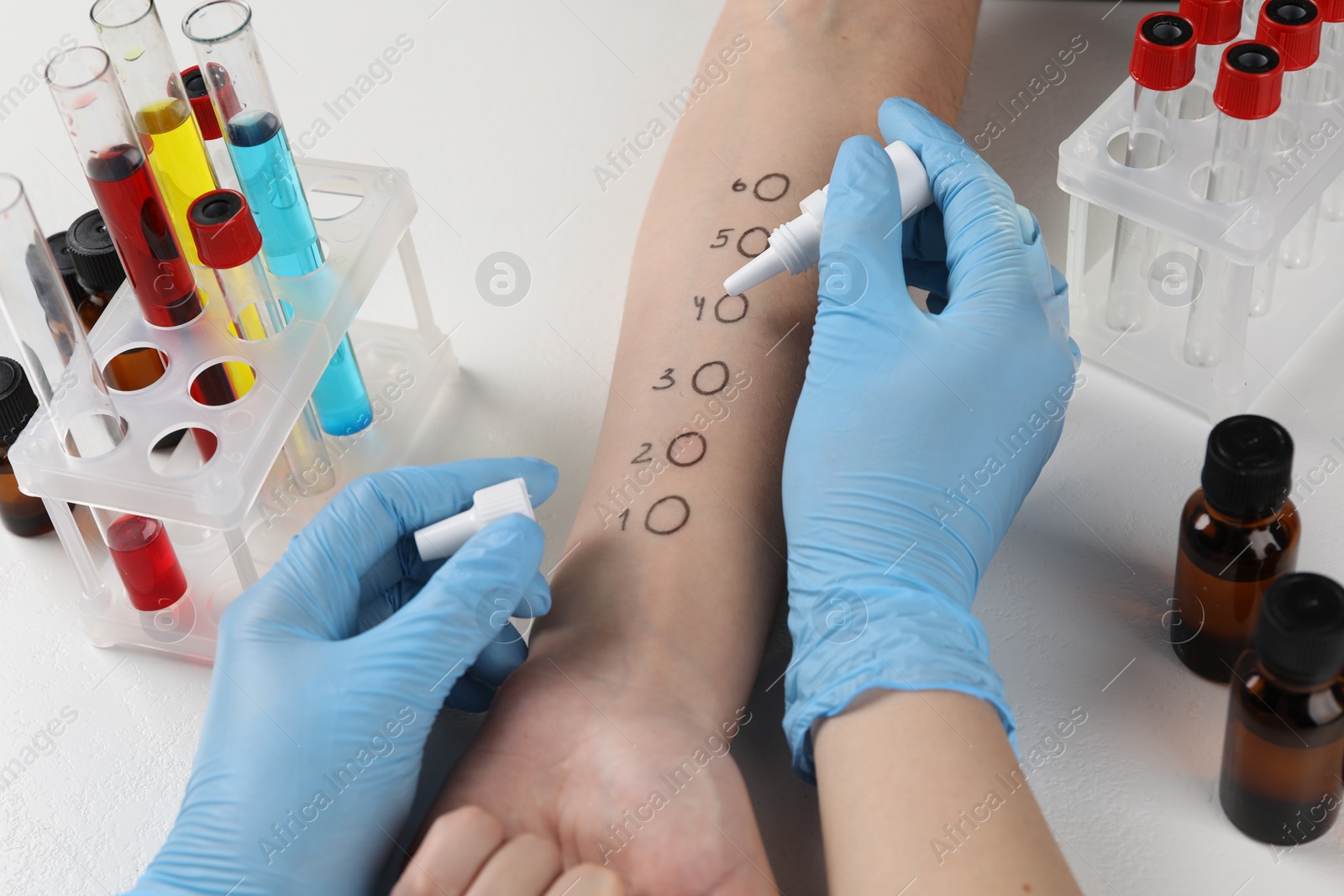 Photo of Doctor doing skin allergy test at light table, closeup