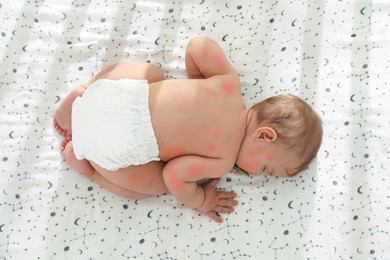 Cute little baby with allergic redness sleeping on soft bed, top view