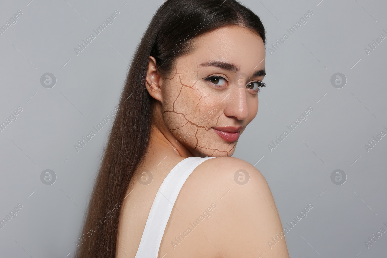 Image of Beautiful young woman with dry skin on grey background