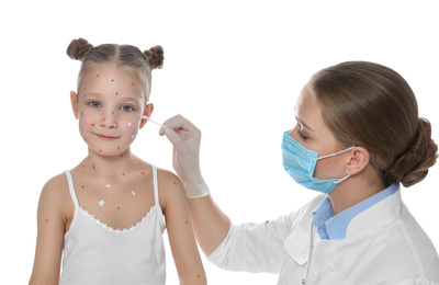 Photo of Doctor applying cream onto skin of little girl with chickenpox against white background. Varicella zoster virus