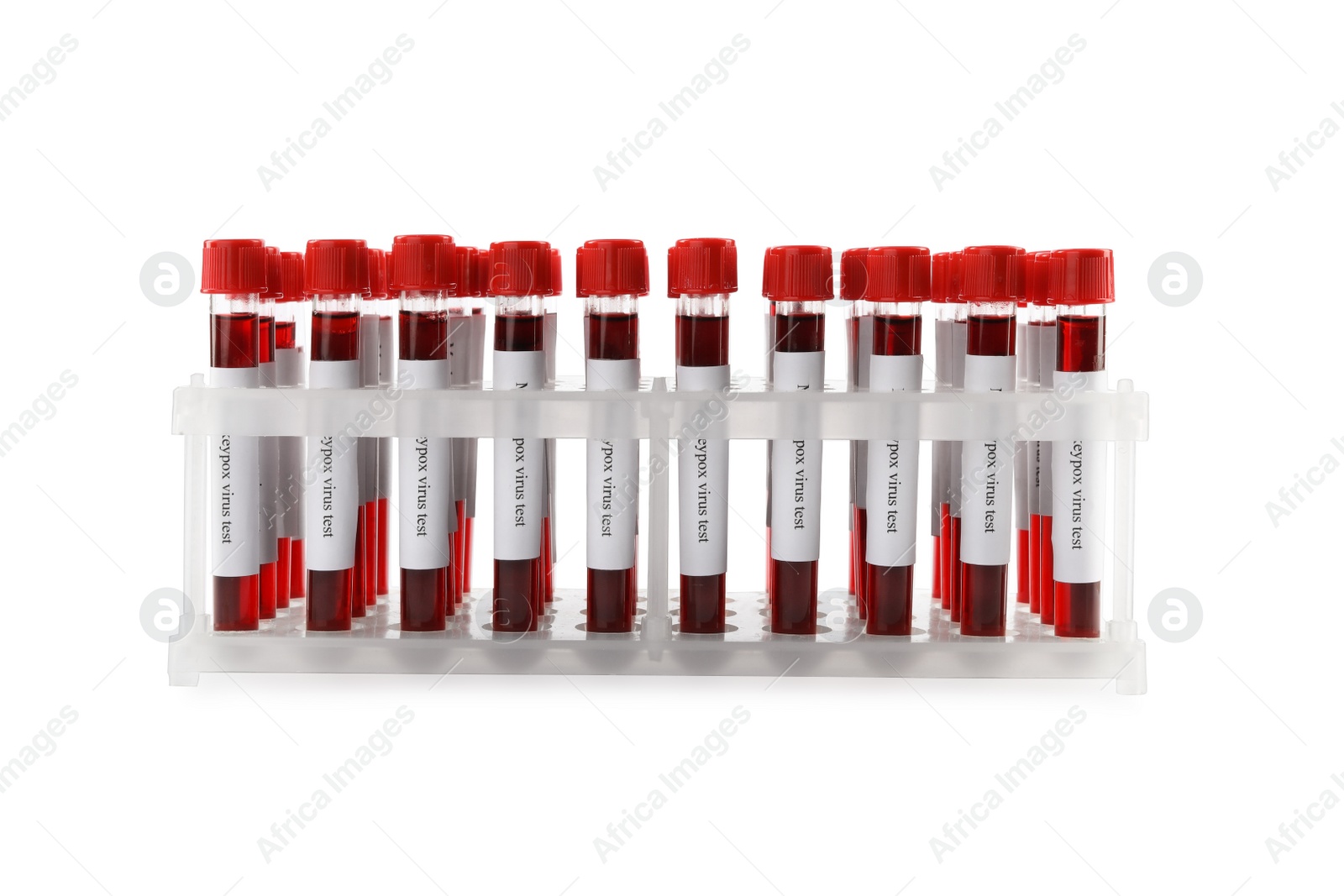 Photo of Monkeypox virus test. Many sample tubes with blood in rack on white background