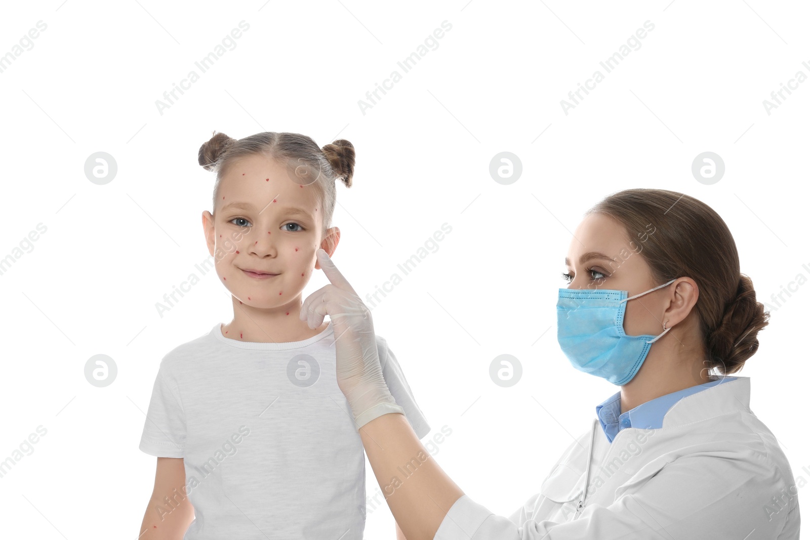 Photo of Doctor examining little girl with chickenpox on white background. Varicella zoster virus