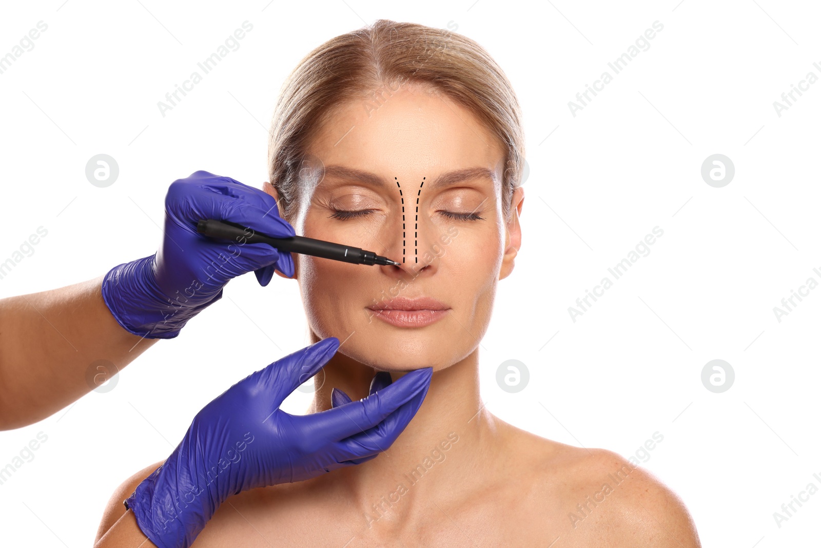 Image of Woman preparing for cosmetic surgery, white background. Doctor drawing markings on her face, closeup