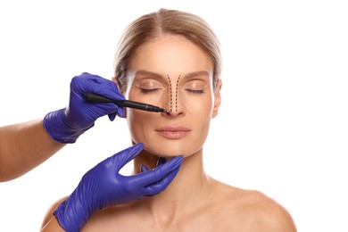 Image of Woman preparing for cosmetic surgery, white background. Doctor drawing markings on her face, closeup