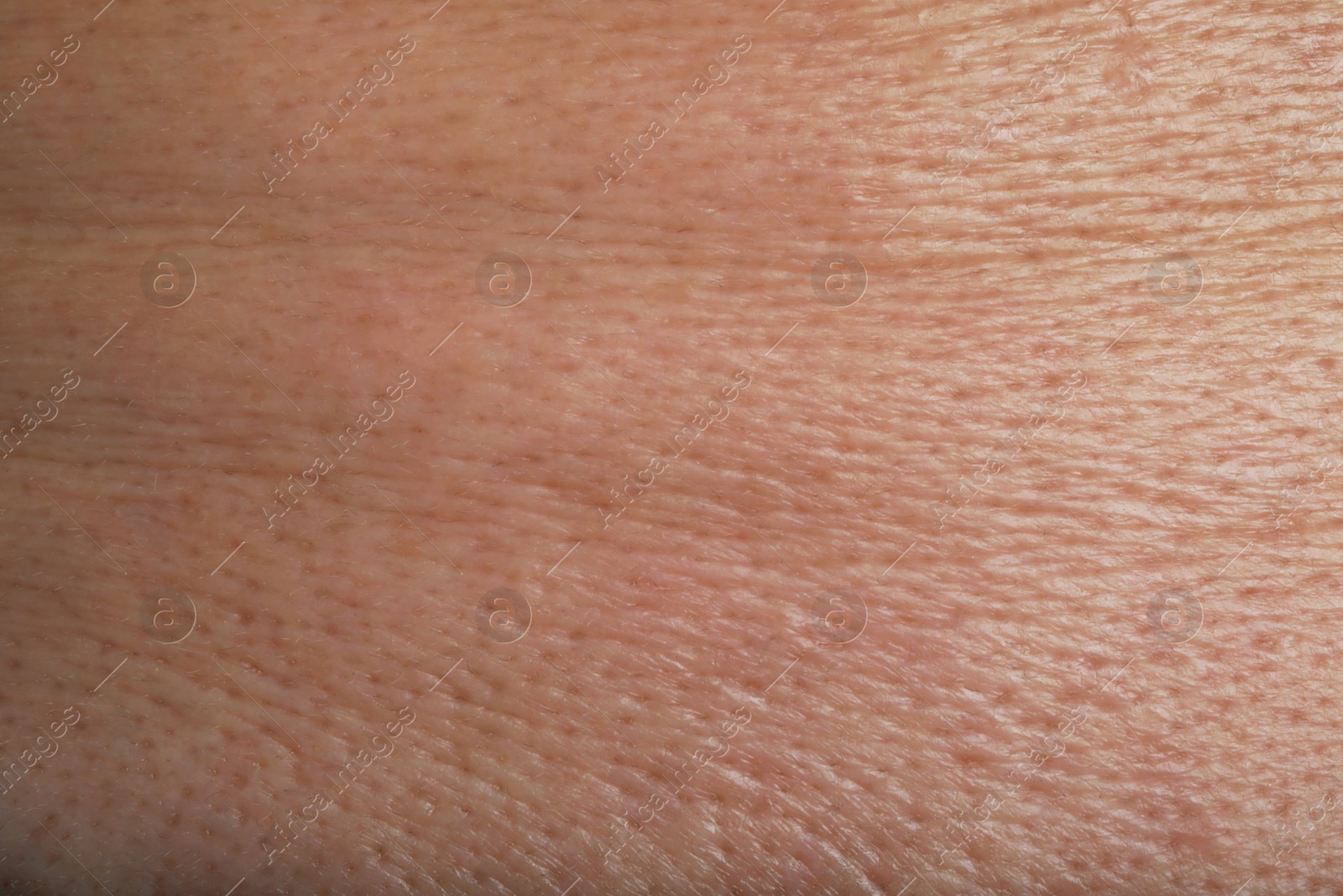 Photo of Closeup view of human skin as background