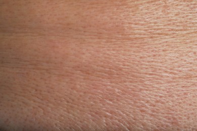 Photo of Closeup view of human skin as background