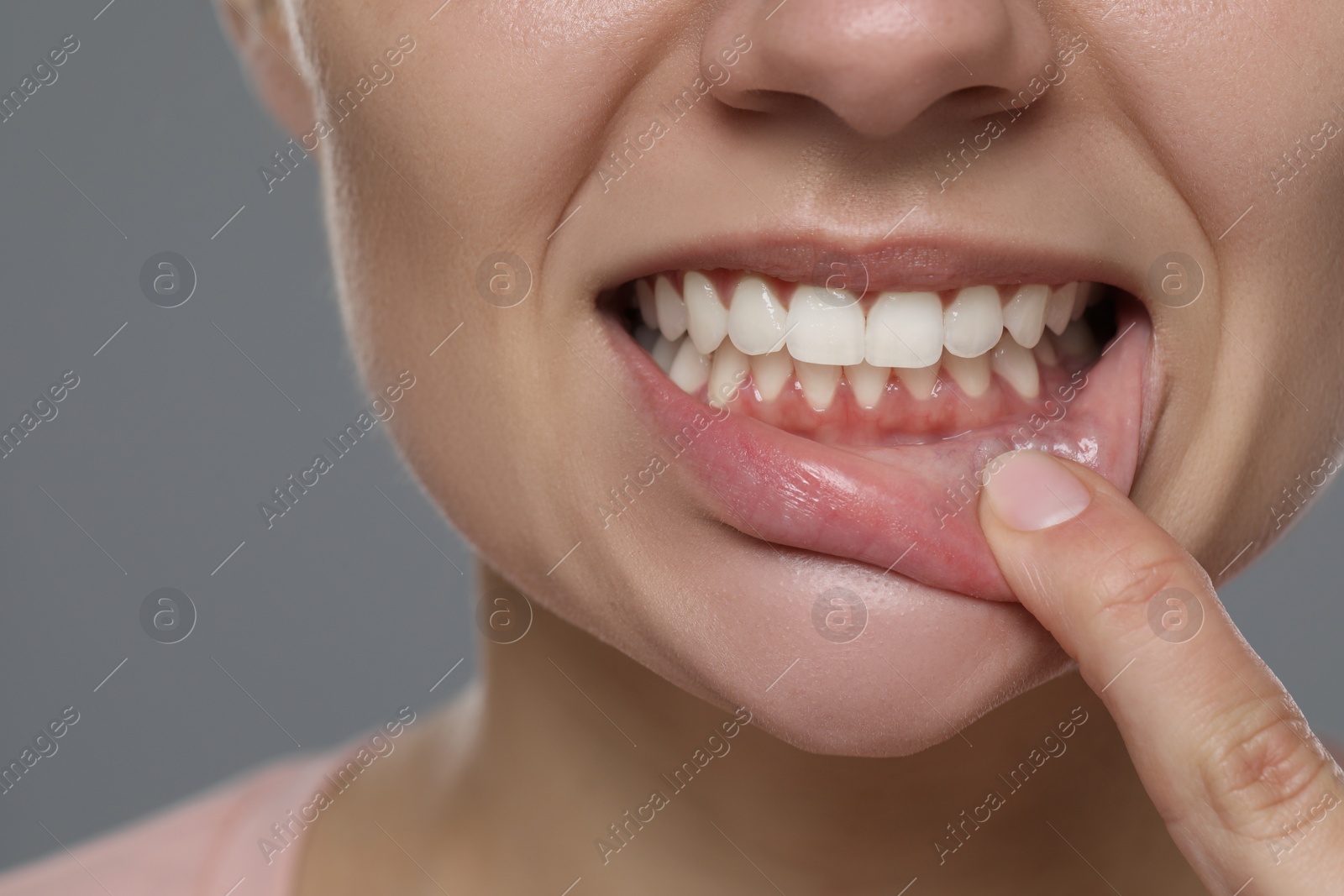 Photo of Woman showing healthy gums on gray background, closeup