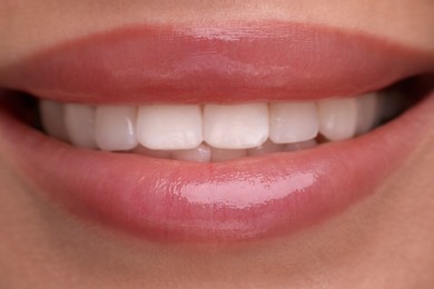 Photo of Woman with beautiful lips smiling, closeup view