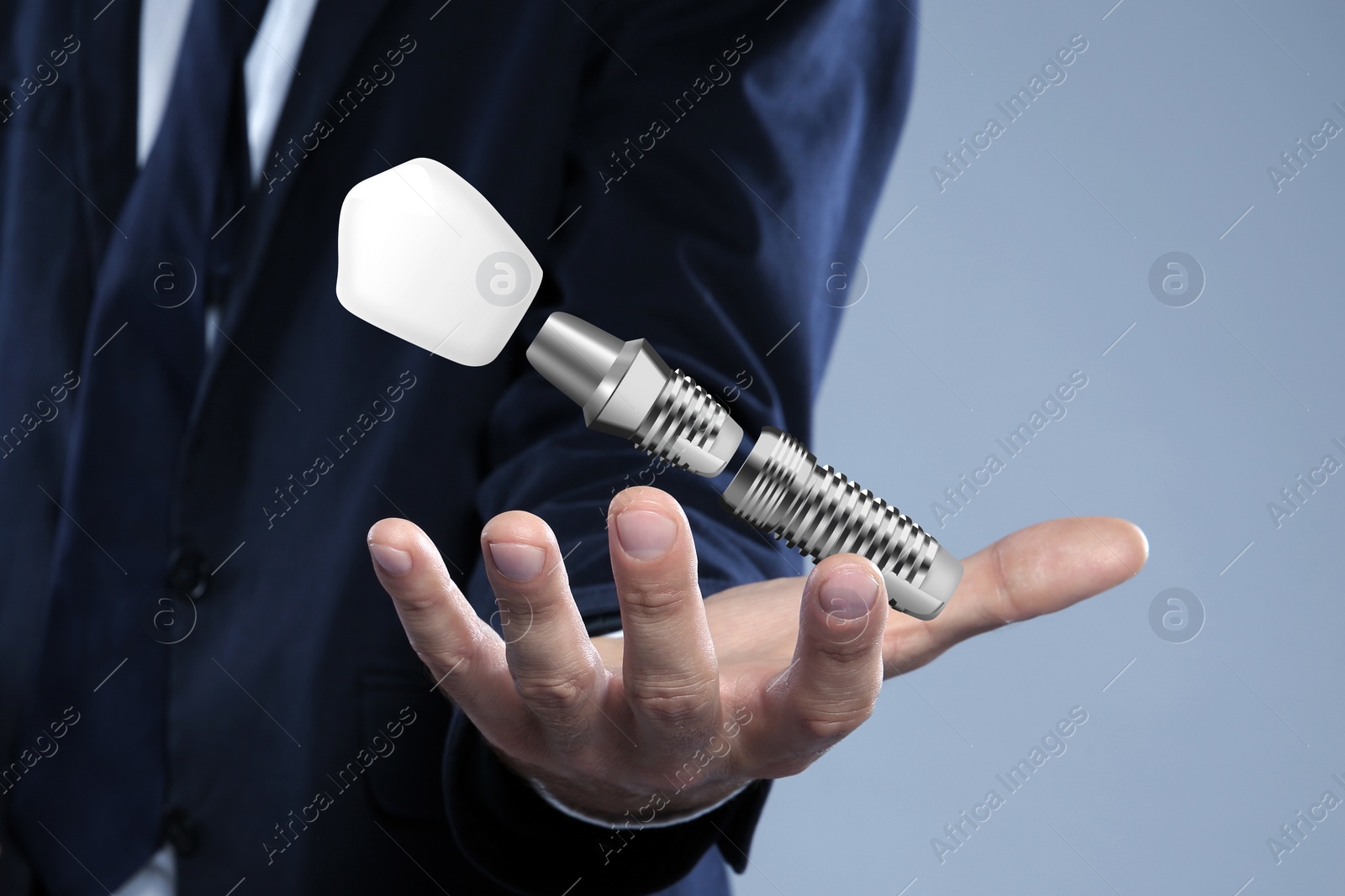 Image of Man demonstrating dental implant on light background, closeup