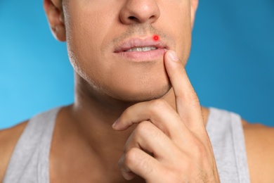 Man with herpes touching lip against light blue background, closeup