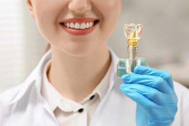 Dentist holding educational model of dental implant indoors, closeup