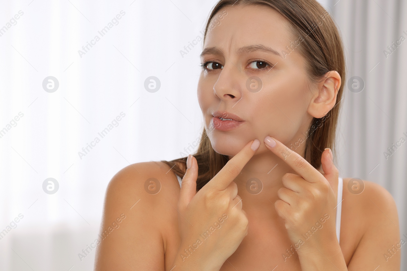 Photo of Woman with skin problem indoors, view from mirror