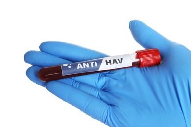 Photo of Scientist holding tube with blood sample and label Anti HAV on white background, closeup