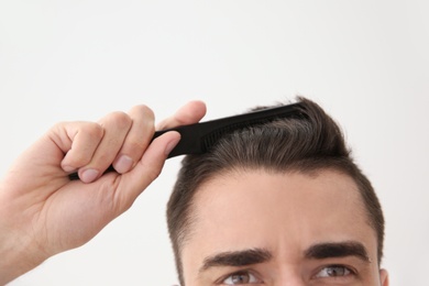 Young man with hair loss problem on light background