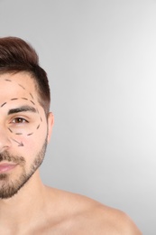 Photo of Young man with marks on face for cosmetic surgery operation against grey background, space for text