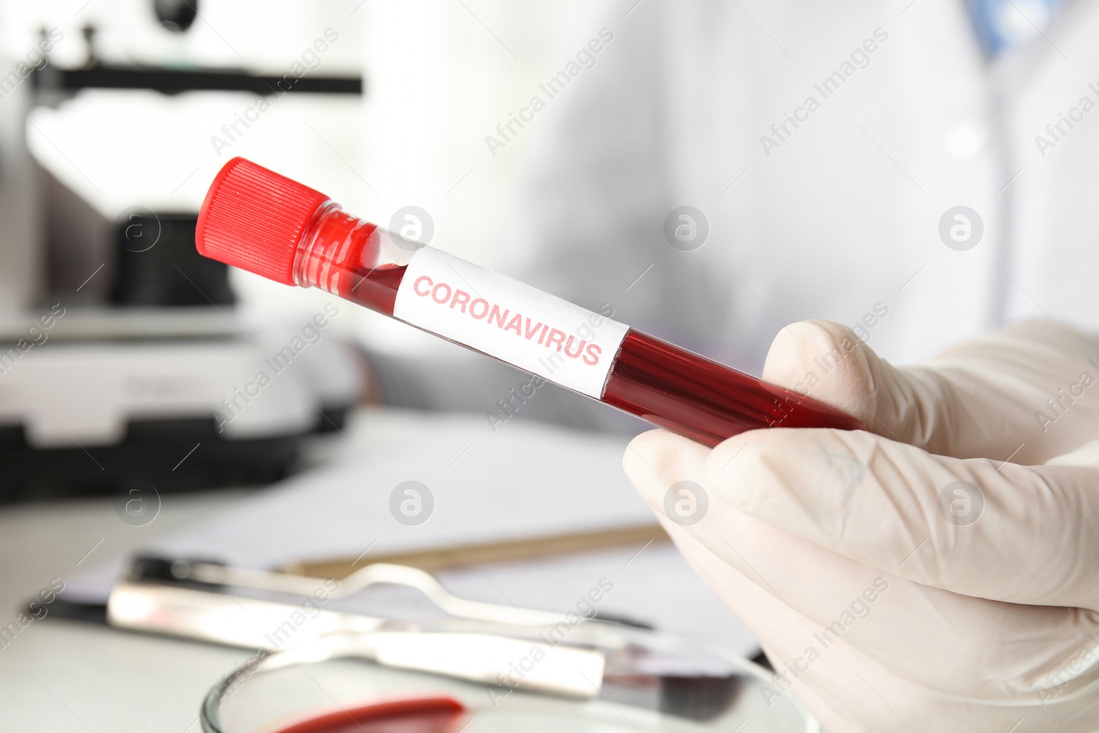 Photo of Scientist holding test tube with blood sample and label CORONA VIRUS in laboratory, closeup