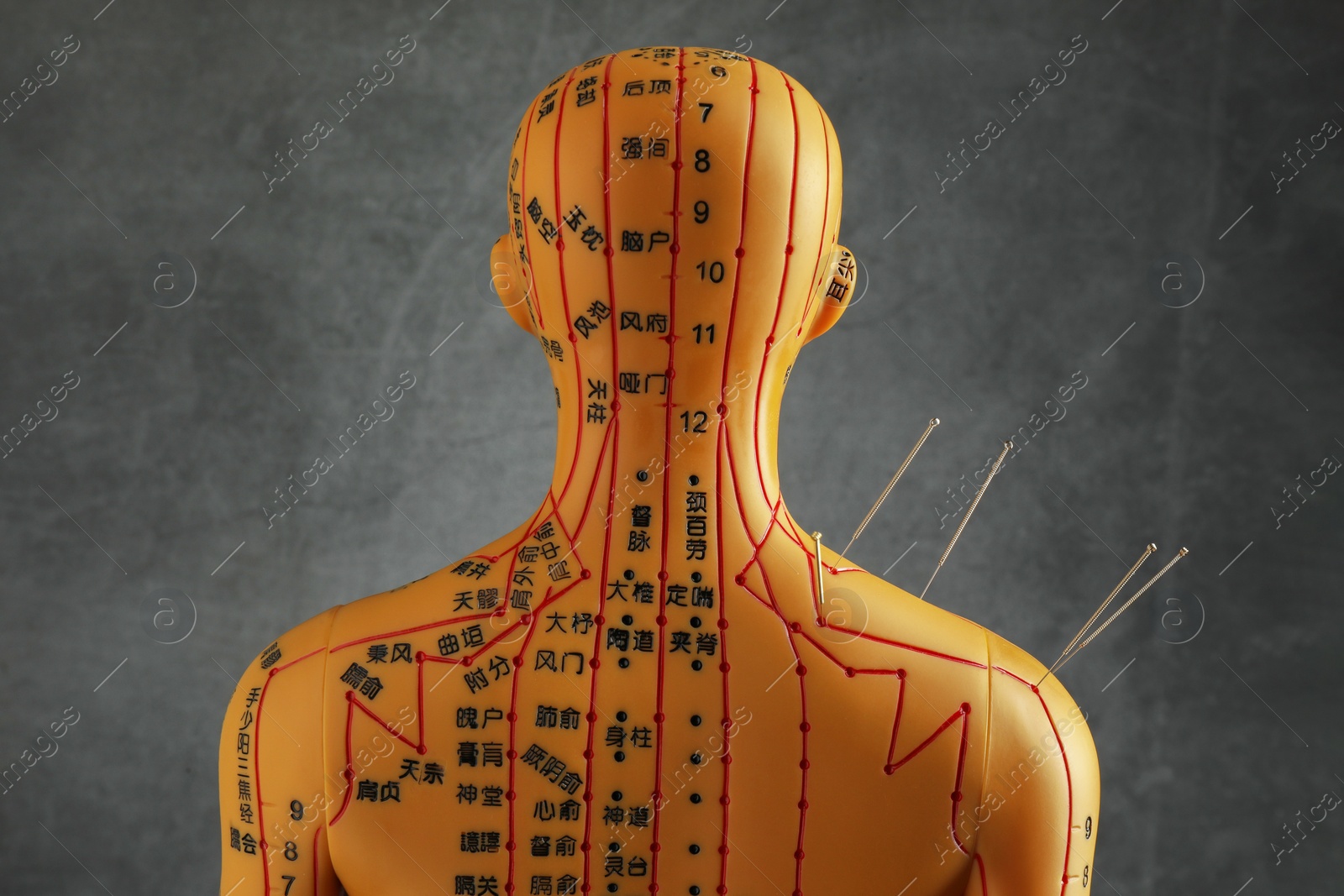 Photo of Acupuncture - alternative medicine. Human model with needles in shoulder near dark grey background, back view