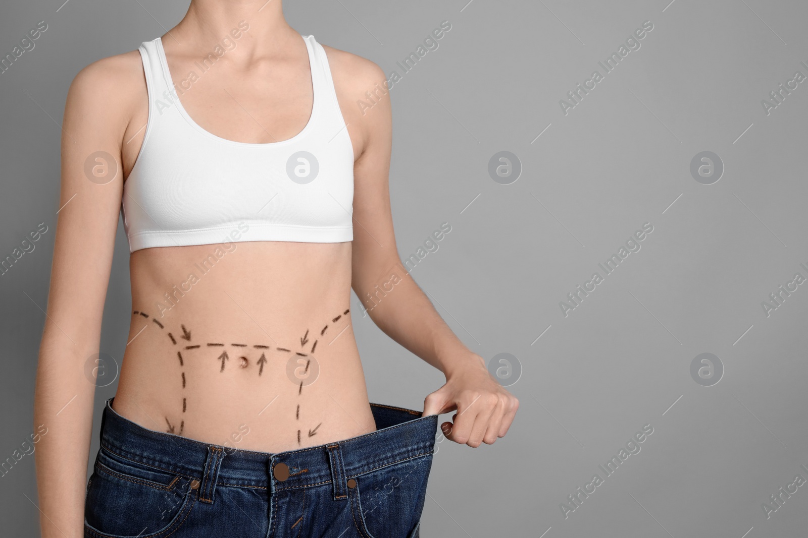 Photo of Young woman with marks on belly in big jeans after cosmetic surgery operation against color background