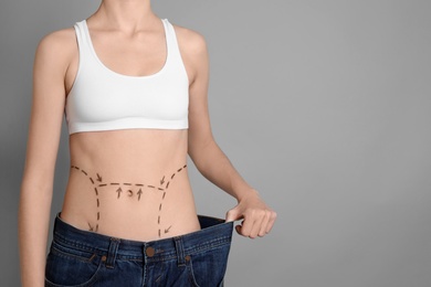 Young woman with marks on belly in big jeans after cosmetic surgery operation against color background