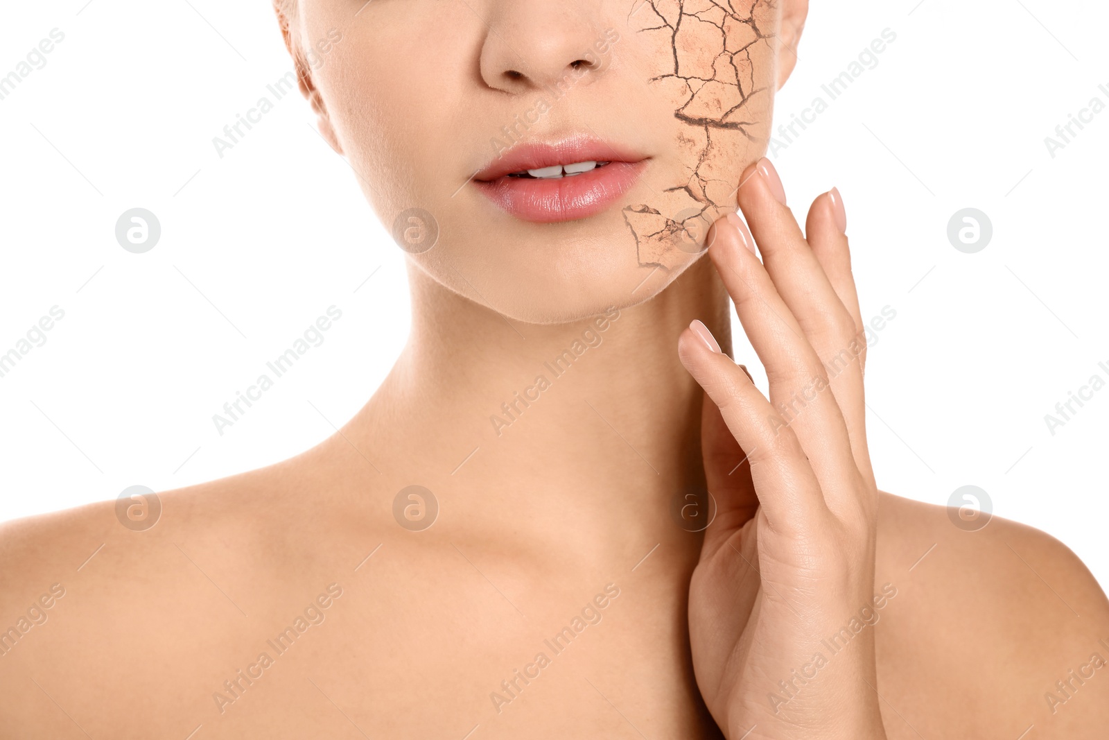 Image of Beautiful young woman with dry skin on white background, closeup