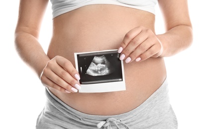 Pregnant woman with ultrasound picture on white background, closeup