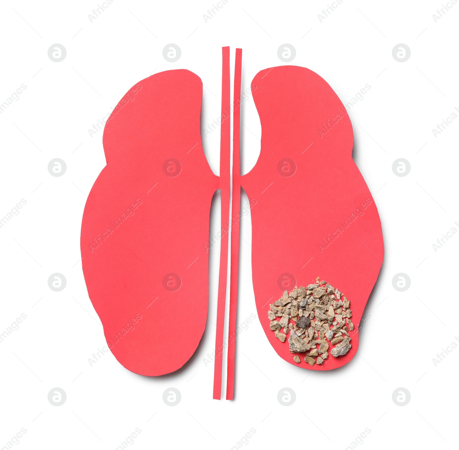 Photo of Paper cutout with stones on white background, top view. Kidney stone disease