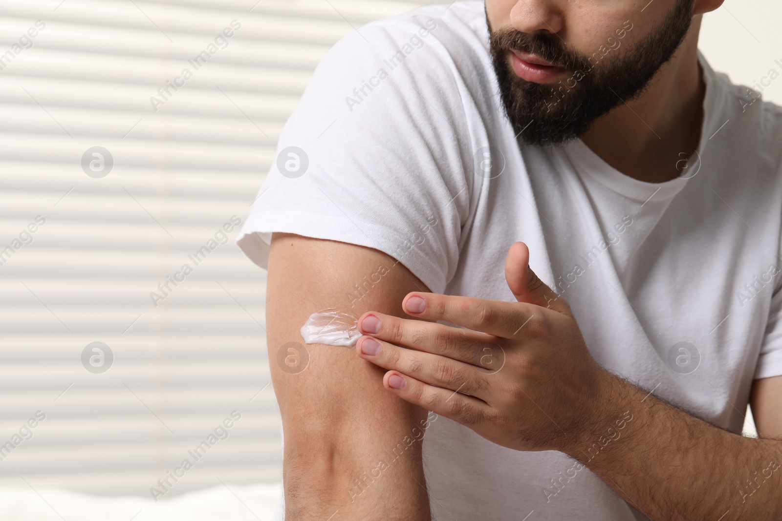 Photo of Man with dry skin applying cream onto his arm indoors, closeup. Space for text