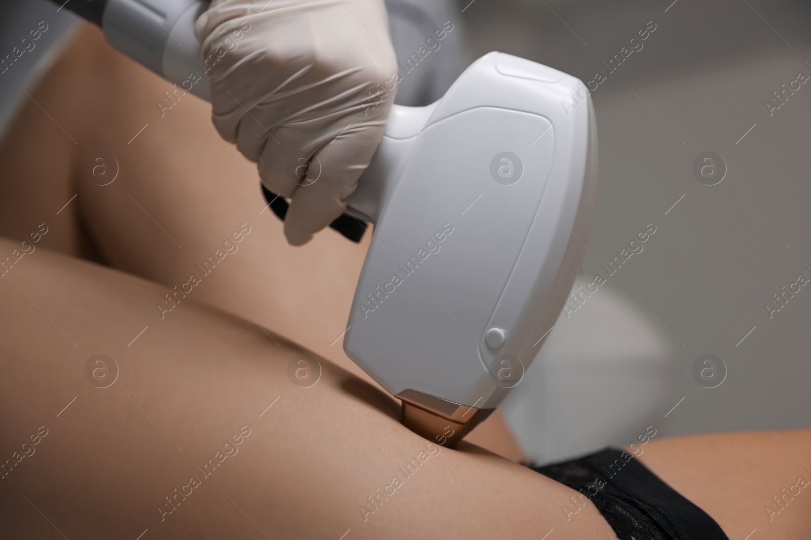 Photo of Woman undergoing laser epilation procedure, closeup view