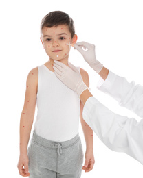 Doctor applying cream onto skin of little boy with chickenpox on white background. Varicella zoster virus