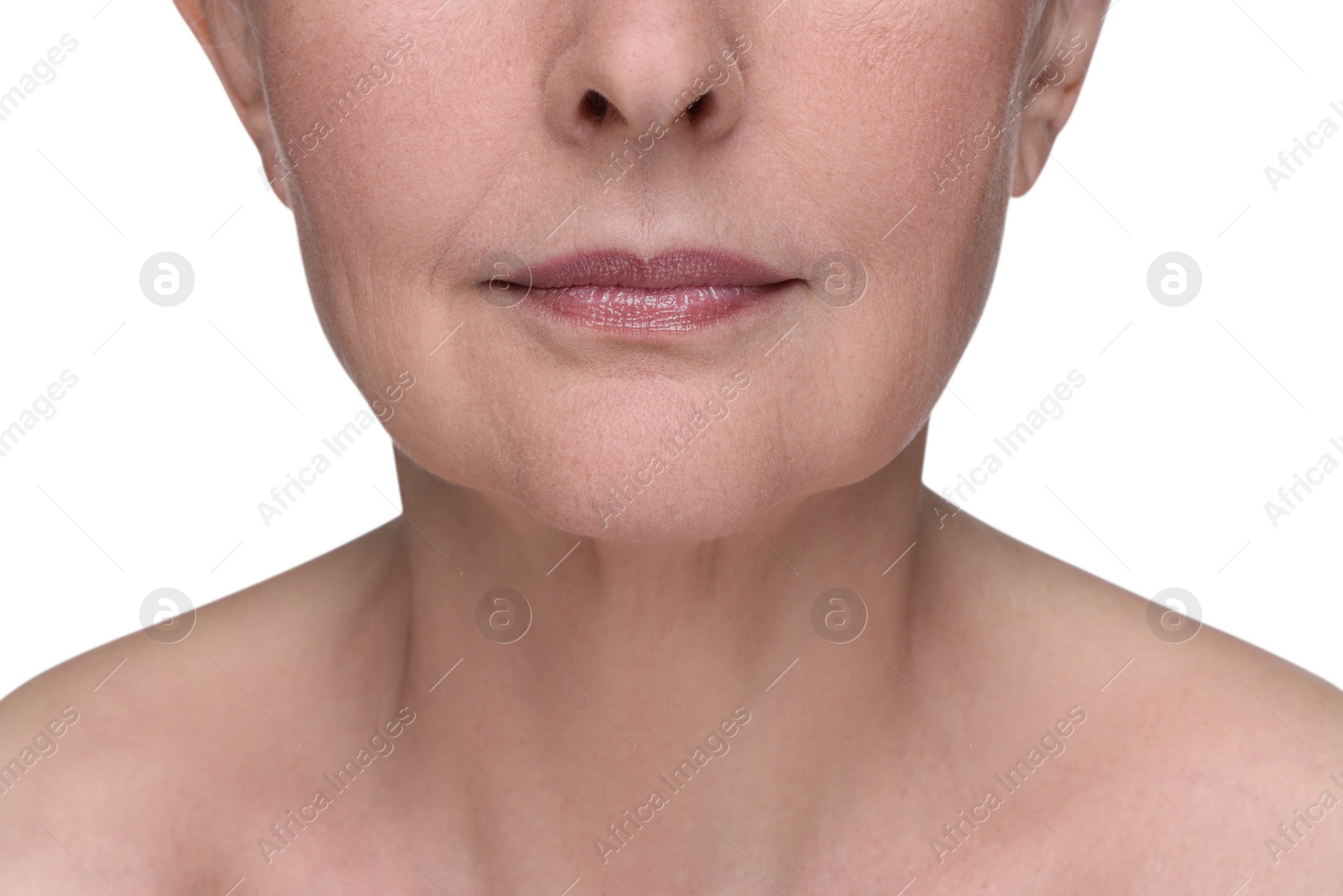 Photo of Senior woman with aging skin on white background, closeup. Rejuvenation treatment