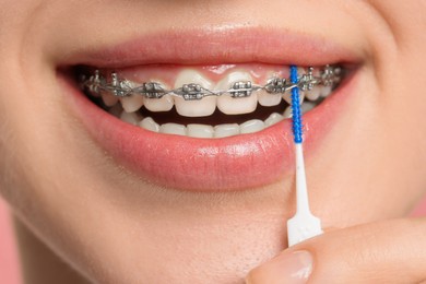 Photo of Smiling woman with dental braces cleaning teeth using interdental brush, closeup