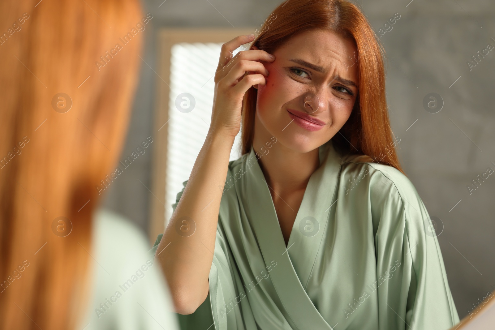 Photo of Suffering from allergy. Young woman checking her face near mirror in bathroom