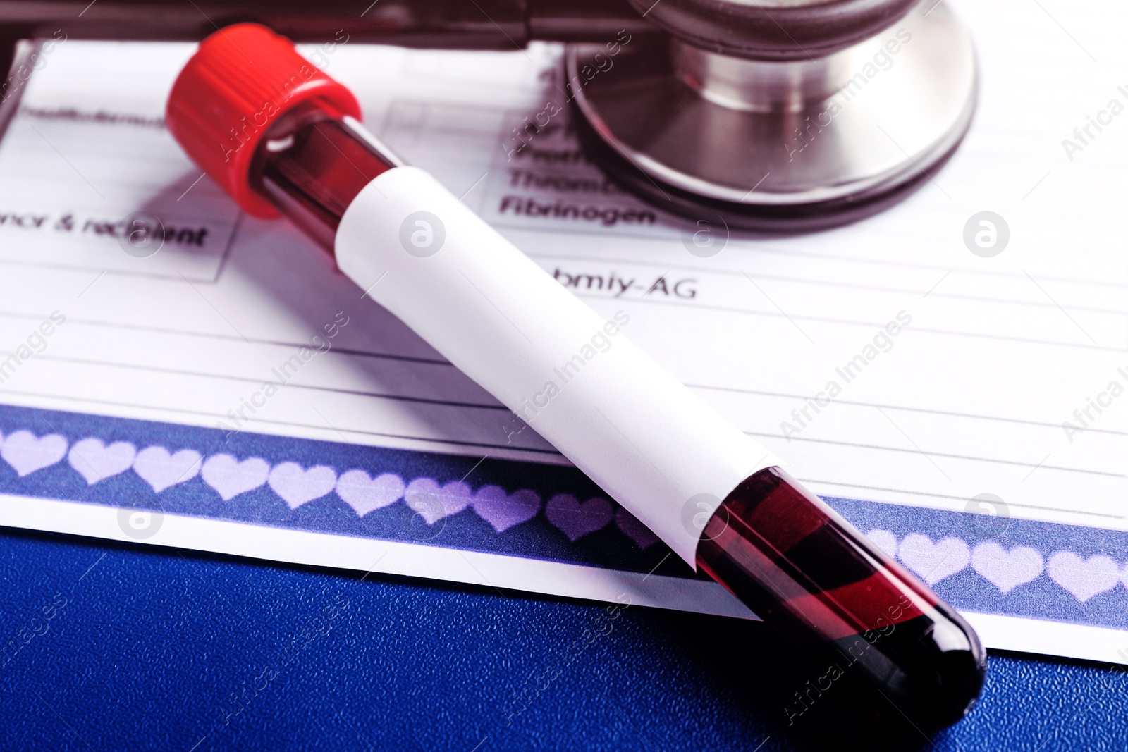 Image of Test tube with blood sample on medical form