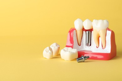 Photo of Educational model of gum with dental implant between teeth on yellow background. Space for text