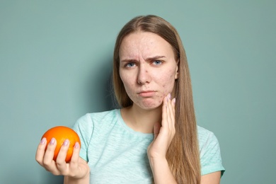 Young woman with acne problem holding orange on color background. Skin allergy