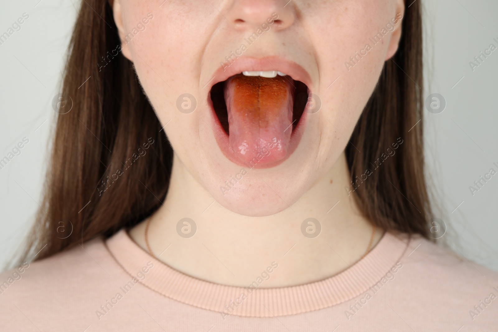 Photo of Gastrointestinal diseases. Woman showing her yellow tongue on light grey background, closeup