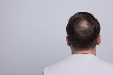 Photo of Baldness concept. Man with bald spot on light grey background, back view. Space for text