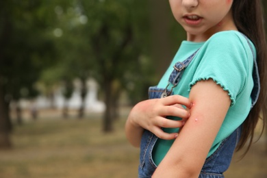 Photo of Girl scratching arm with insect bites in park, closeup. Space for text