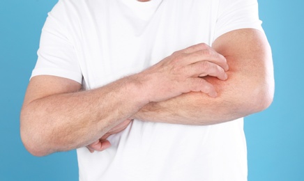 Senior man scratching forearm on color background, closeup. Allergy symptom