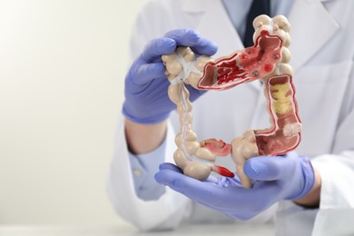 Doctor with model of large intestine, selective focus