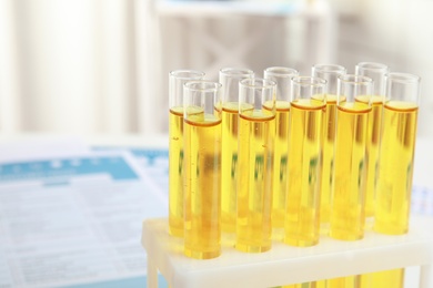 Photo of Test tubes with urine samples for analysis, closeup