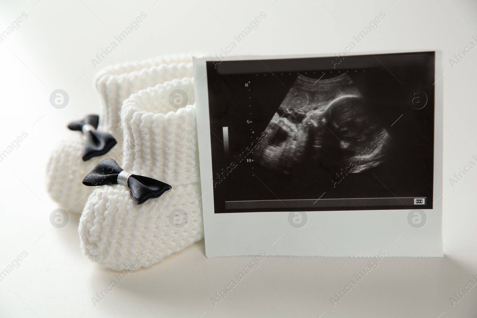 Photo of Ultrasound photo of baby and knitted boots on white background