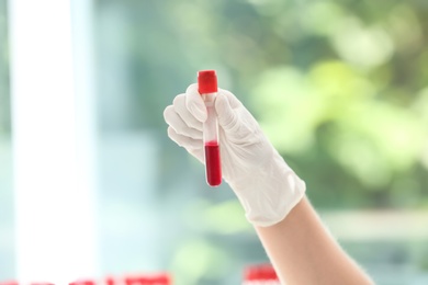 Scientist holding test tube with blood sample in laboratory