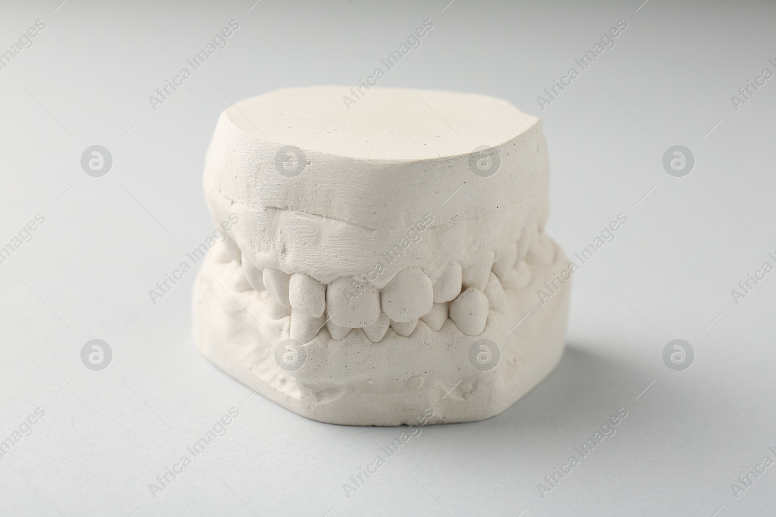 Photo of Dental model with gums on light grey background. Cast of teeth