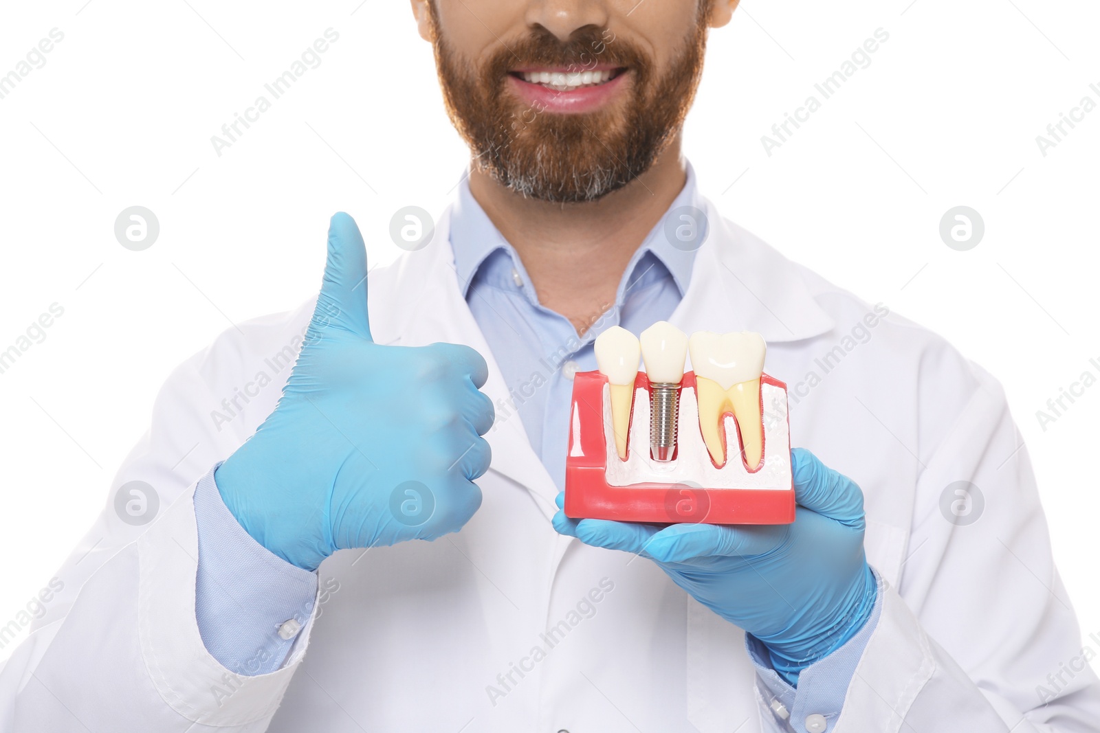 Photo of Dentist holding educational model of dental implant on white background, closeup