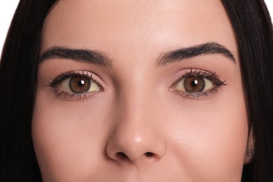Photo of Woman with yellow eyes as background, closeup. Liver problems symptom