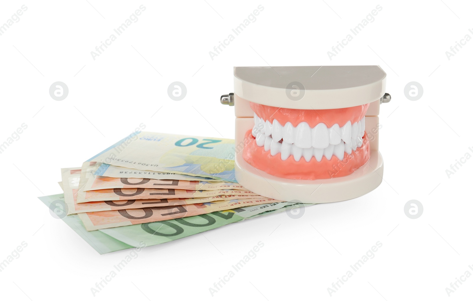 Photo of Educational dental typodont model and euro banknotes on white background. Expensive treatment