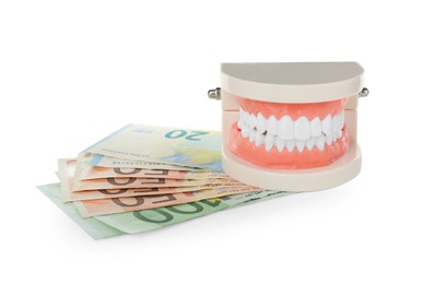 Photo of Educational dental typodont model and euro banknotes on white background. Expensive treatment